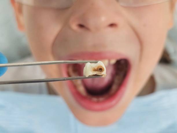 Best Dentist for Severe Toothache  in Mion, AR